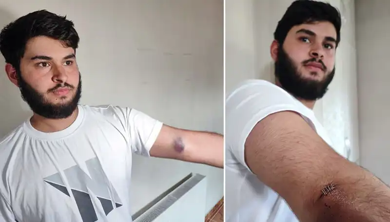 Bahçeye Kaçan Top, Mahallede Gergin Anların Yaşanmasına Neden Oldu