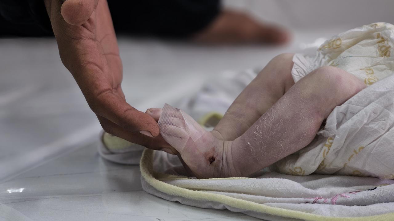 Gazze'de Donarak Ölen Bebek Sayısı 6'ya Yükseldi